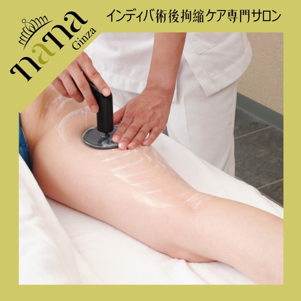 太ももにインディバを当てる施術